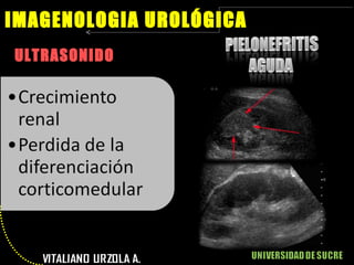 ULTRASONIDO IMAGENOLOGIA UROLÓGICA 
