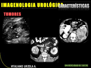 TUMORES IMAGENOLOGIA UROLÓGICA 