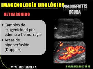 ULTRASONIDO IMAGENOLOGÍA UROLÓGICA 
