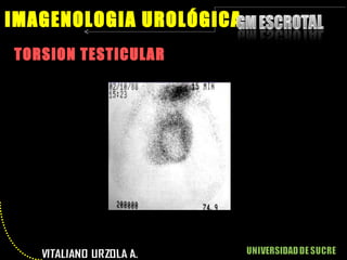 TORSION TESTICULAR IMAGENOLOGIA UROLÓGICA 