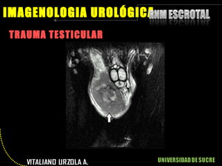 TRAUMA TESTICULAR IMAGENOLOGIA UROLÓGICA 