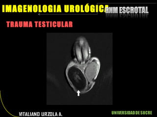 TRAUMA TESTICULAR IMAGENOLOGIA UROLÓGICA 