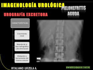UROGRAFÍA EXCRETORA IMAGENOLOGÍA UROLÓGICA 