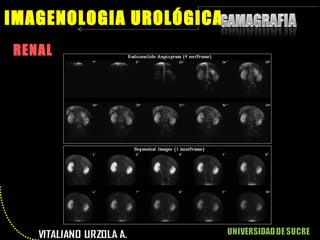 RENAL IMAGENOLOGIA UROLÓGICA 