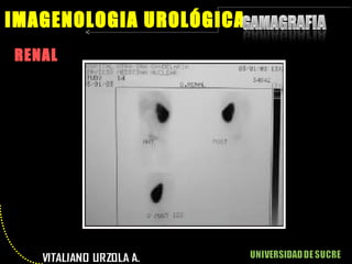 RENAL IMAGENOLOGIA UROLÓGICA 