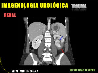 RENAL IMAGENOLOGIA UROLÓGICA 