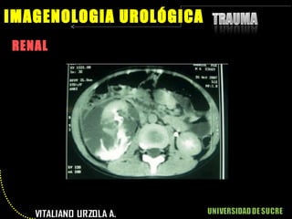 RENAL IMAGENOLOGIA UROLÓGICA 