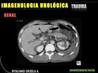 RENAL IMAGENOLOGIA UROLÓGICA 