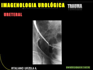 URETERAL IMAGENOLOGIA UROLÓGICA 