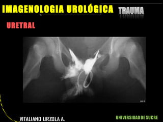 URETRAL IMAGENOLOGIA UROLÓGICA 