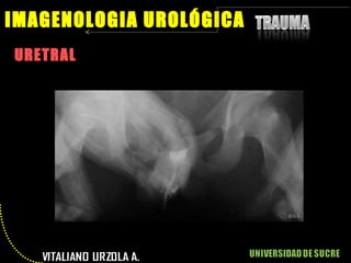 URETRAL IMAGENOLOGIA UROLÓGICA 