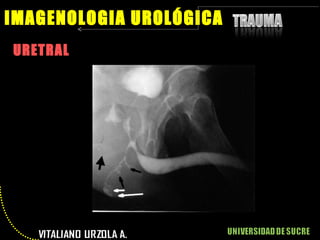 URETRAL IMAGENOLOGIA UROLÓGICA 