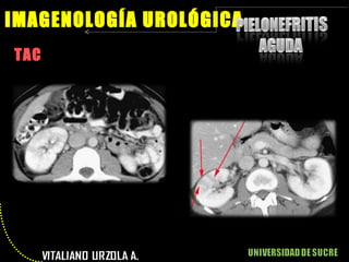 TAC IMAGENOLOGÍA UROLÓGICA 