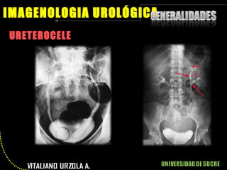 Imagenologia Urologica