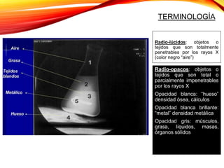 Radio-lúcidos: objetos o
tejidos que son totalmente
penetrables por los rayos X
(color negro “aire”)
Radio-opacos: objetos o
tejidos que son total o
parcialmente impenetrables
por los rayos X
Opacidad blanca: “hueso”
densidad ósea, cálculos
Opacidad blanca brillante:
“metal” densidad metálica
Opacidad gris: músculos,
grasa, líquidos, masas,
órganos sólidos
TERMINOLOGÍA
 
