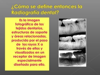 Es la imagen
fotográfica de los
tejidos dentarios,
estructuras de soporte
y áreas relacionadas,
producida por el paso
de los rayos X a
través de ellos y
visualizados en un
receptor de imagen
especialmente
diseñado para ello.
 