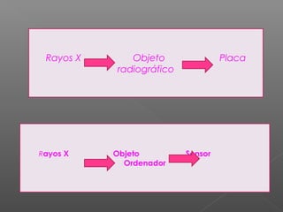 Rayos X Objeto Placa
radiográfico
Rayos X Objeto Sensor
Ordenador
 