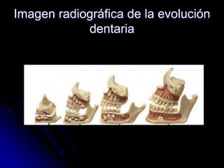 Imagen radiográfica de la evolución
dentaria
 
