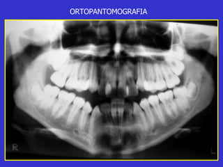 ORTOPANTOMOGRAFIA 