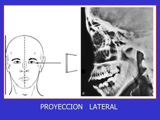 PROYECCION  LATERAL 