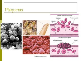 Plaquetas 