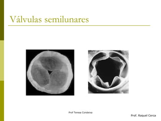Válvulas semilunares Prof. Raquel Cerca 