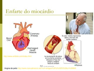 Enfarte do miocárdio http://www.enfarte.com/index.html Angina de peito  http://www.manualmerck.net/?url=/artigos/%3Fid%3D53%26cn%3D665 
