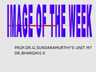 PROF.DR.G.SUNDARAMURTHY’S UNIT M7
DR.BHARGAVI.K
 