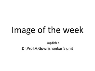 Image of the week
Jagdish K
Dr.Prof.A.Gowrishankar’s unit
 