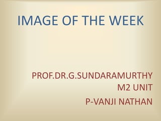 IMAGE OF THE WEEK
PROF.DR.G.SUNDARAMURTHY
M2 UNIT
P-VANJI NATHAN
 