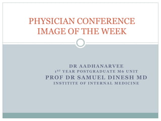 DR AADHANARVEE
1 S T Y E A R P O S T G R A D U A T E M 6 U N I T
PROF DR SAMUEL DINESH MD
I N S T I T I T E O F I N T E R N A L M E D I C I N E
PHYSICIAN CONFERENCE
IMAGE OF THE WEEK
 