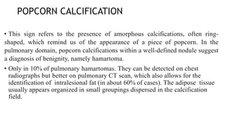 POPCORN CALCIFICATION
• This sign refers to the presence of amorphous calcifications, often ring-
shaped, which remind us of the appearance of a piece of popcorn. In the
pulmonary domain, popcorn calcifications within a well-defined nodule suggest
a diagnosis of benignity, namely hamartoma.
• Only in 10% of pulmonary hamartomas. They can be detected on chest
radiographs but better on pulmonary CT scan, which also allows for the
identification of intralesional fat (in about 60% of cases). The adipose tissue
usually appears organized in small groupings dispersed in the calcification
field.
 