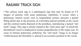 RAILWAY TRACK SIGN
• The railway track sign is a radiological sign that may be found on CT
images of patients with acute pulmonary embolism; it occurs when a
pulmonary arterial vessel, seen in longitudinal section, presents a partial
filling defect due to the presence of a thrombus placed centrally at the vessel
and the contrast media disposed at the periphery, reproducing a typical “rail
track” image. This sign is strictly related to the “polo mint sign” in which the
thrombosed vessel is displayed in section perpendicular to the major axis. In
cases of chronic pulmonary embolism, the “rail track” image is no longer
visible because the thrombus is placed in an eccentric position to the vessel.
 