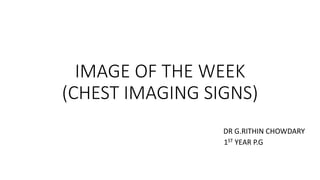 IMAGE OF THE WEEK
(CHEST IMAGING SIGNS)
DR G.RITHIN CHOWDARY
1ST YEAR P.G
 