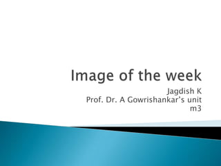 Image of the week Jagdish K Prof. Dr. A Gowrishankar’s unit m3 
