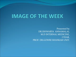 Presented by DR.ISHWARYA  ANNAMALAI, M.D INTERNAL MEDICINE, I YEAR, PROF. DR.GOWRI SHANKAR UNIT. 