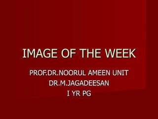 IMAGE OF THE WEEK PROF.DR.NOORUL AMEEN UNIT DR.M.JAGADEESAN I YR PG 