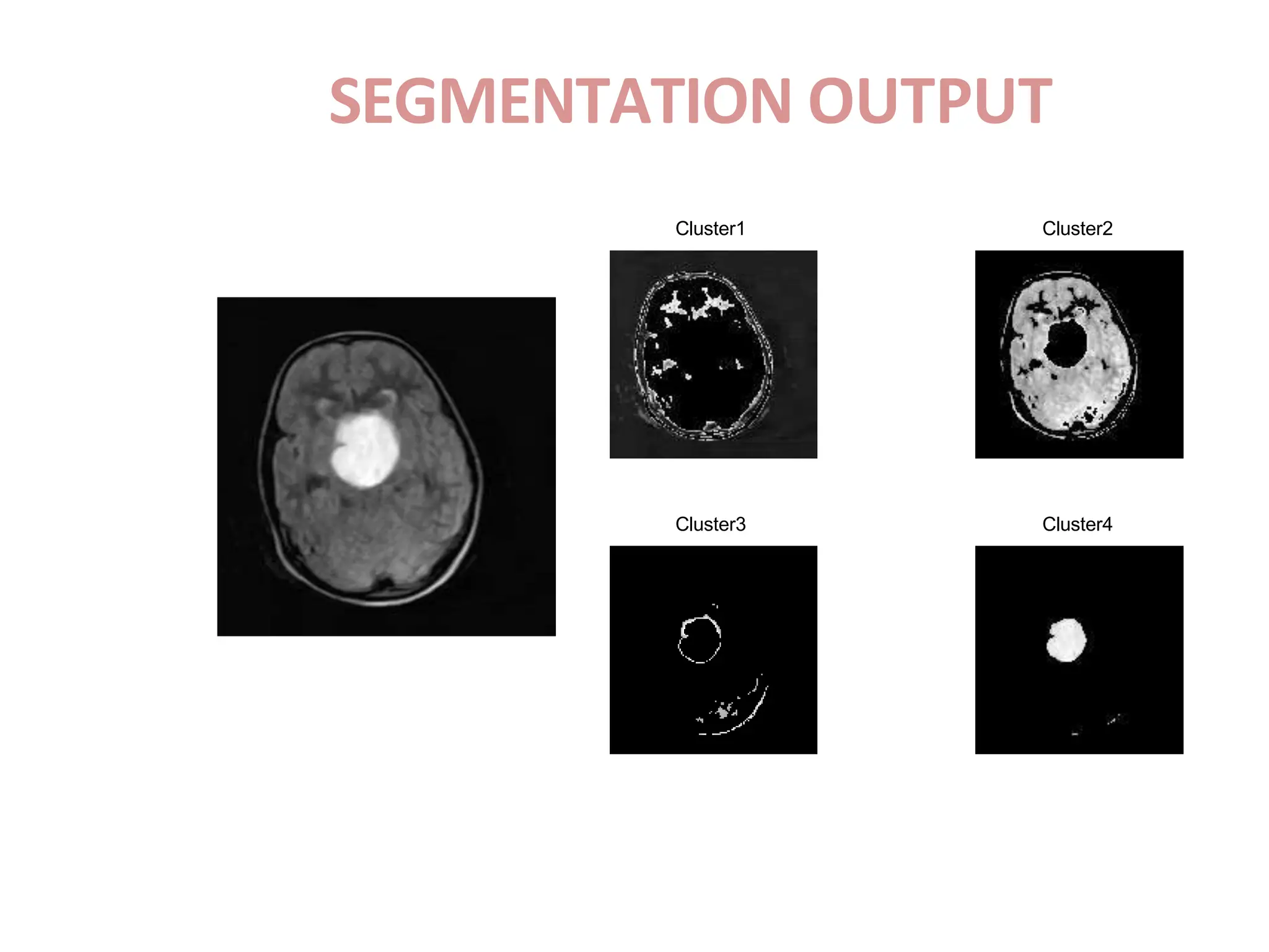 SEGMENTATION OUTPUT
Cluster1 Cluster2
Cluster3 Cluster4
 