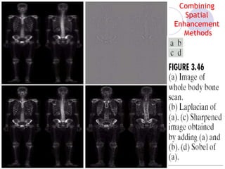 Combining
Spatial
Enhancement
Methods
 