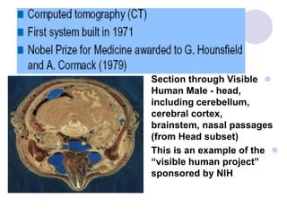 Section through Visible
Human Male - head,
including cerebellum,
cerebral cortex,
brainstem, nasal passages
(from Head subset)
This is an example of the
“visible human project”
sponsored by NIH
 