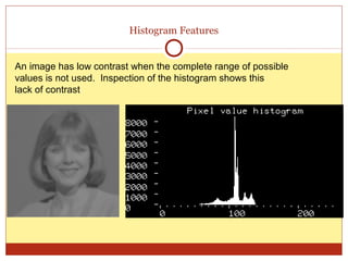 Histogram Features


An image has low contrast when the complete range of possible
values is not used. Inspection of the histogram shows this
lack of contrast.
 