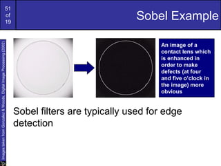 51
of
19
Sobel Example
Sobel filters are typically used for edge
detection
ImagestakenfromGonzalez&Woods,DigitalImageProcessing(2002)
An image of a
contact lens which
is enhanced in
order to make
defects (at four
and five o’clock in
the image) more
obvious
 