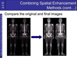 56
of
19
Combining Spatial Enhancement
Methods (cont…)
Compare the original and final images
ImagestakenfromGonzalez&Woods,DigitalImageProcessing(2002)
 