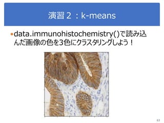 演習２：k-means
63
data.immunohistochemistry()で読み込
んだ画像の色を3色にクラスタリングしよう！
 