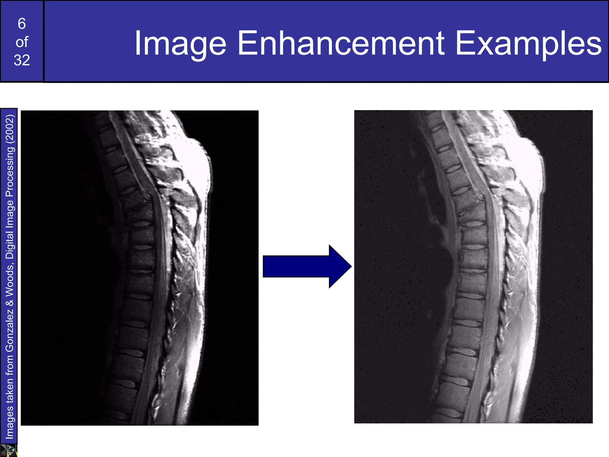 6
of
32
Image Enhancement Examples
Images
taken
from
Gonzalez
&
Woods,
Digital
Image
Processing
(2002)
 