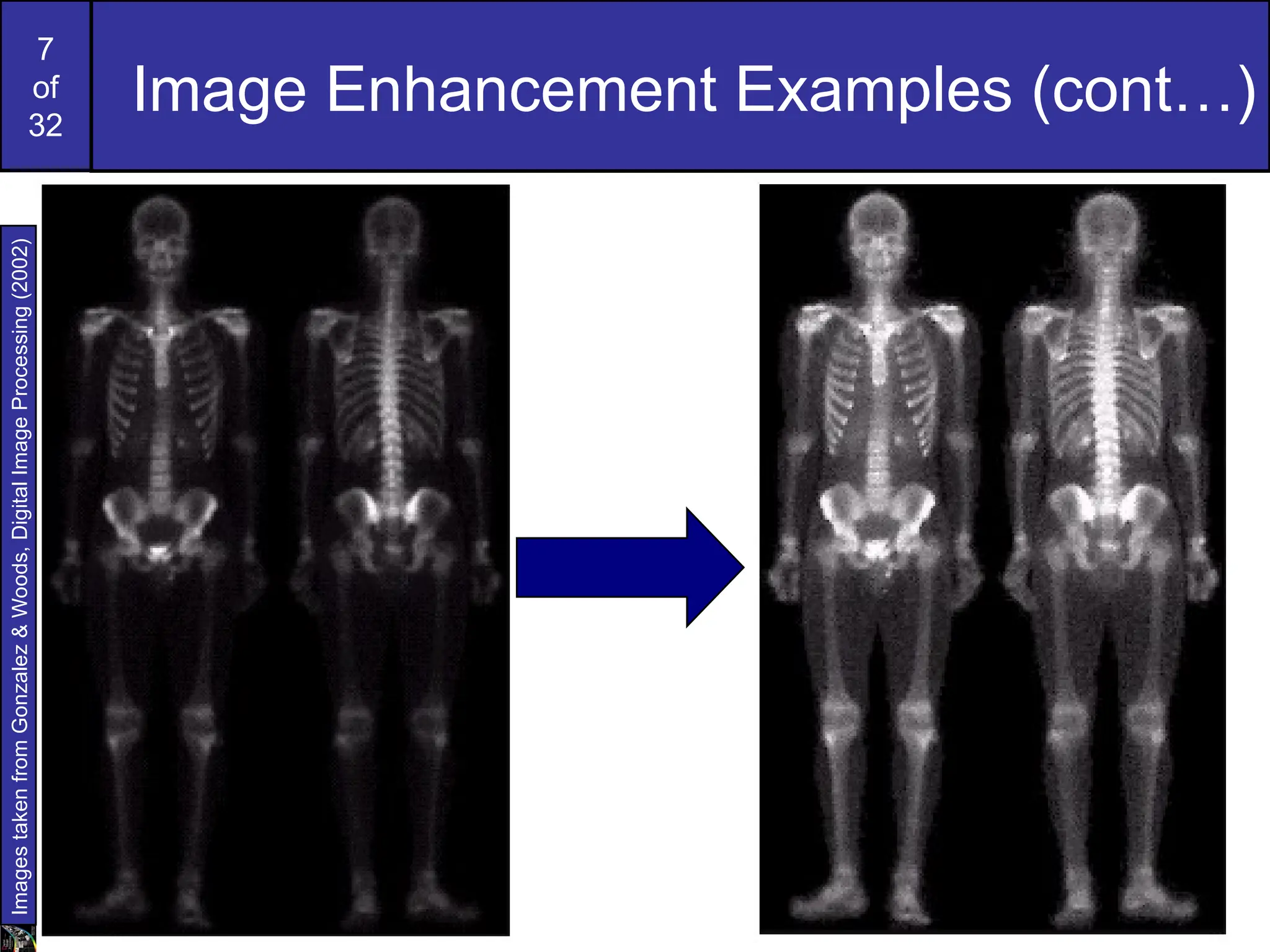 7
of
32
Image Enhancement Examples (cont…)
Images
taken
from
Gonzalez
&
Woods,
Digital
Image
Processing
(2002)
 