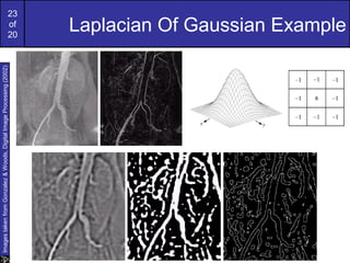 23
of
20
Laplacian Of Gaussian Example
ImagestakenfromGonzalez&Woods,DigitalImageProcessing(2002)
 