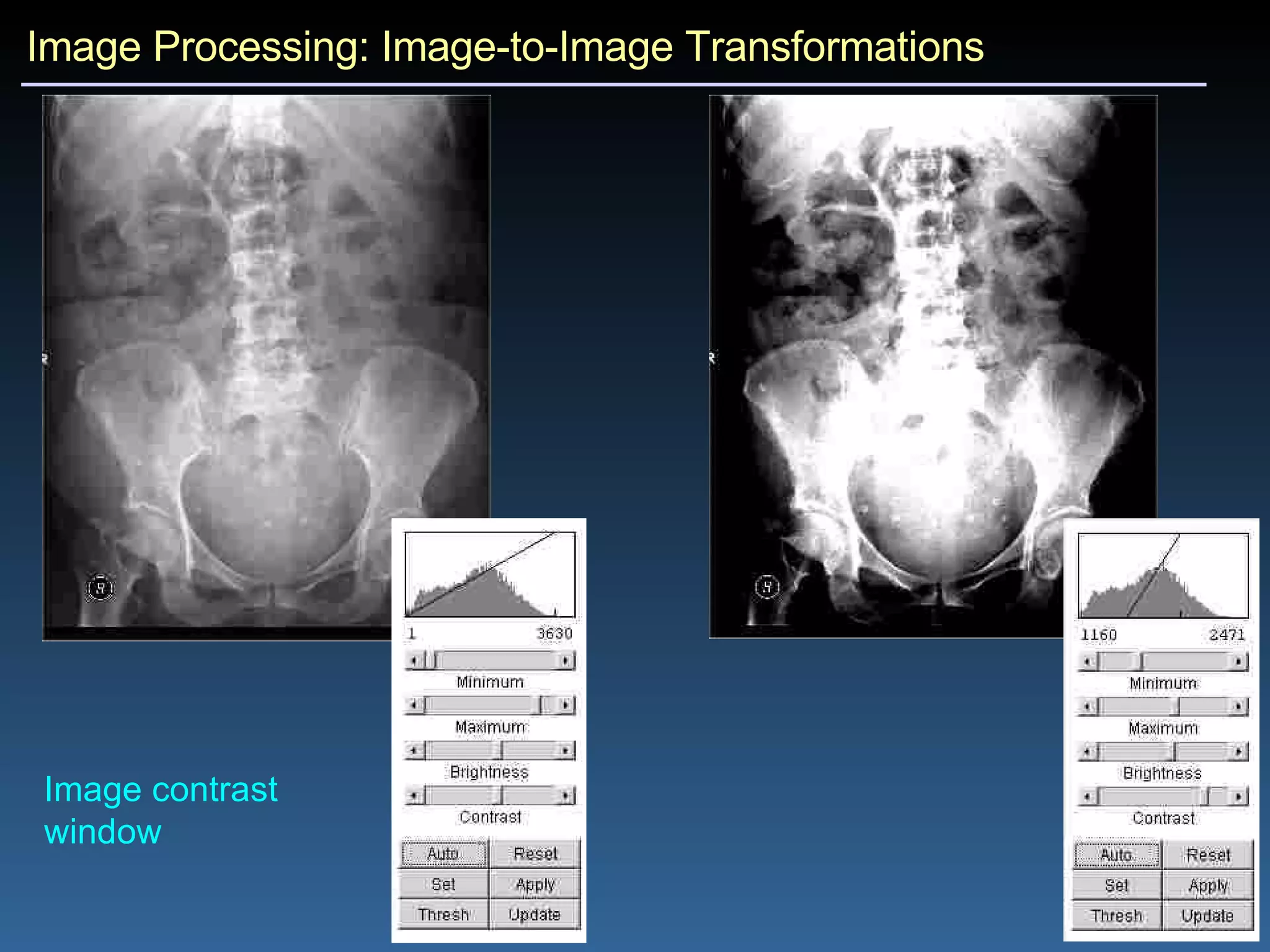 Image Processing: Image-to-Image Transformations Image contrast  window 