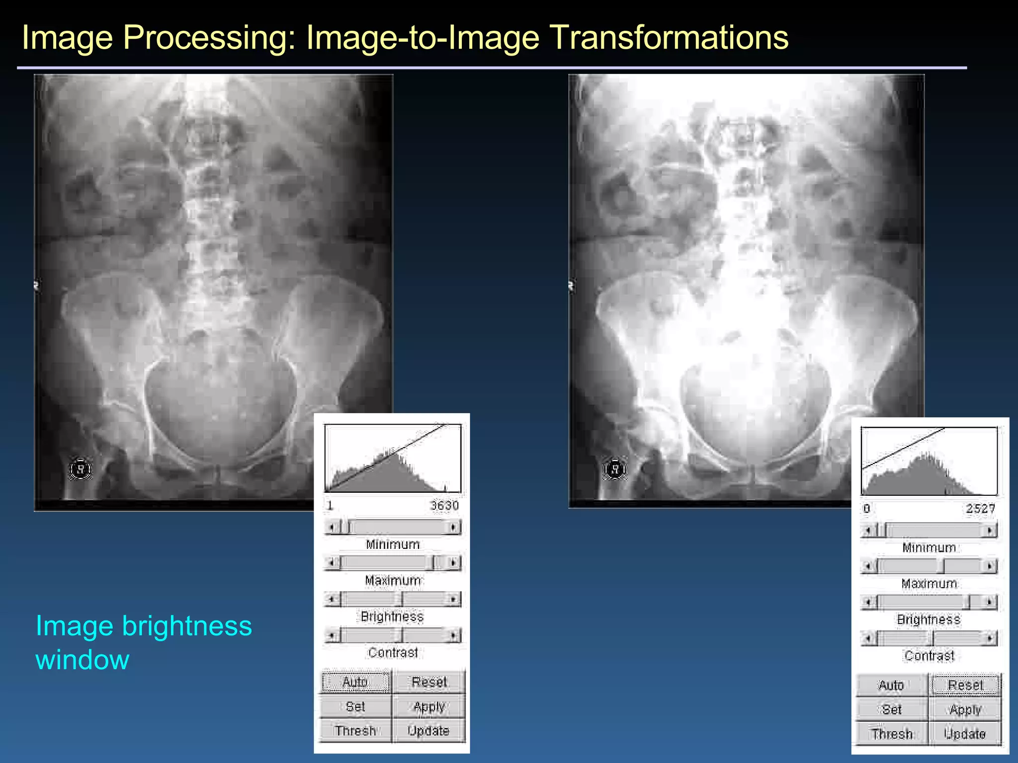 Image Processing: Image-to-Image Transformations Image brightness window 