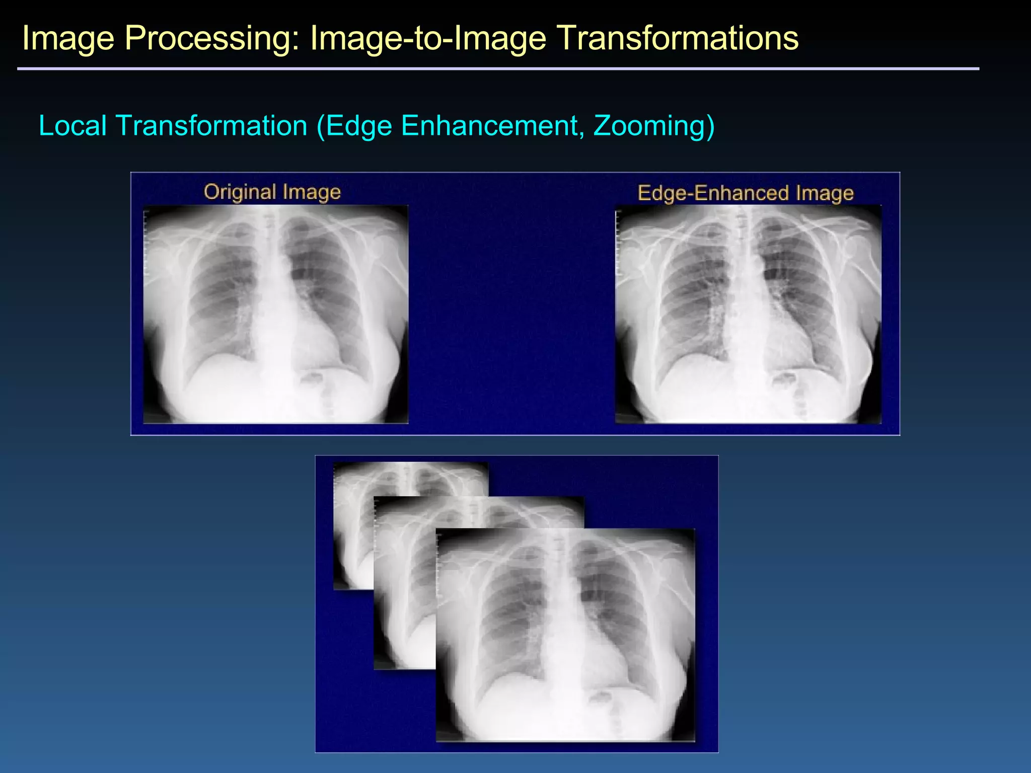 Image Processing: Image-to-Image Transformations Local Transformation (Edge Enhancement, Zooming)  